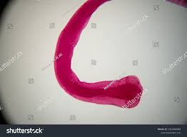 <p>An elderly Russian woman who had recently immigrated to Israel visited her brother living in the United States. While in the United States the woman was found to have a severe anemia. The egg shown below, measuring 60 x 50 µm, was found in her stool specimen. Identify the parasite.<br><br></p><p>ascaris lumbricoides</p><p>Diphyllobothrium latum</p><p>Echinococcus granulosus</p><p>Fasciolopsis buski</p><p>Paragonimus westermani</p>