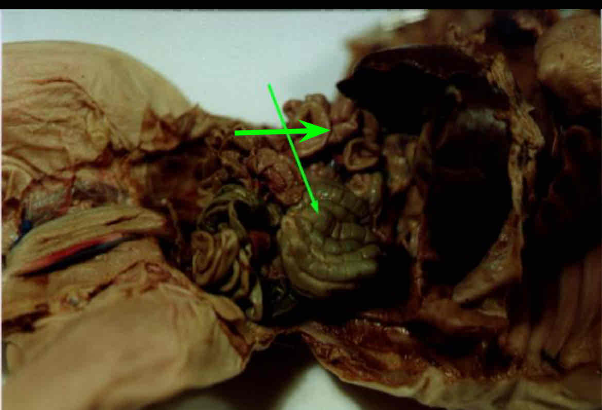 <p>Identify this structure (smaller arrow)</p>
