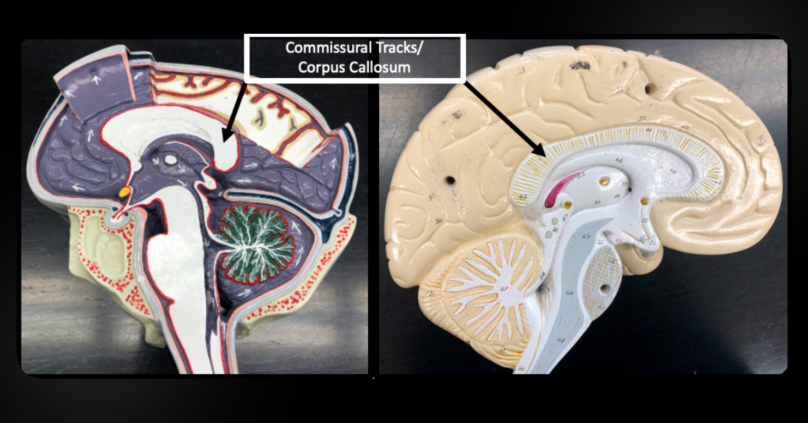 <p>Corpus Callosum</p>