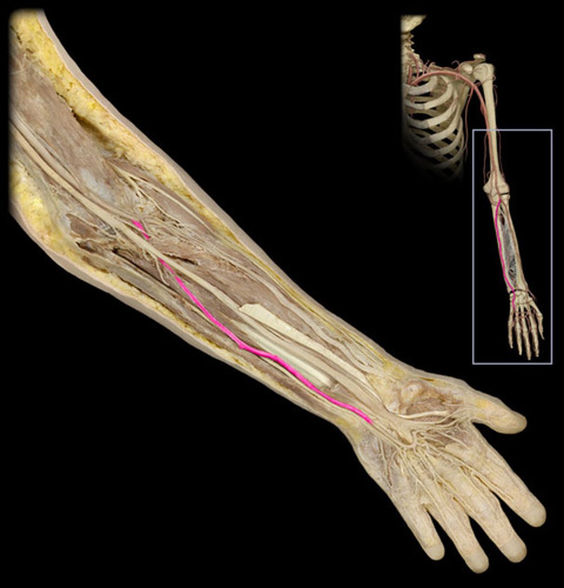 <p>Identify the vessel (include artery vs vein)</p>