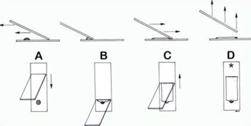 <p>What is this technique called?</p><p>Why is this performed, list 3 reasons?</p>