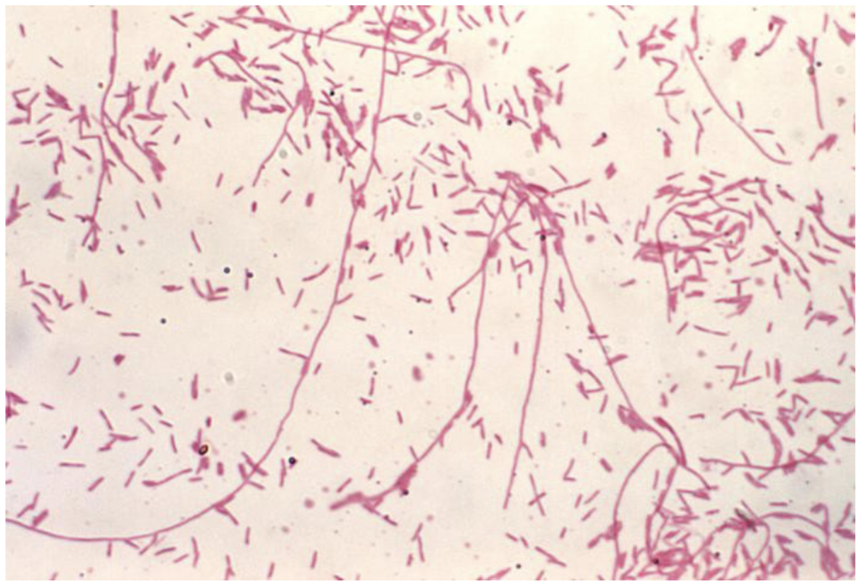 <ul><li><p>Hospitalized patients with enigmatic pneumonia</p></li><li><p>Patients with enigmatic pneumonia sufficiently severe to require care in the ICU</p></li><li><p> Compromised host with pneumonia</p></li><li><p> Patients with pneumonia in the setting of a legionellosis outbreak</p></li><li><p>Patients who fail to respond to treatment to a ß- lactam or cephalosporin</p></li><li><p>Patients that have traveled away from their home within two weeks before the onset of illness</p></li><li><p> Patients suspected of nosocomial pneumonia with unknown etiology</p></li></ul><p></p>