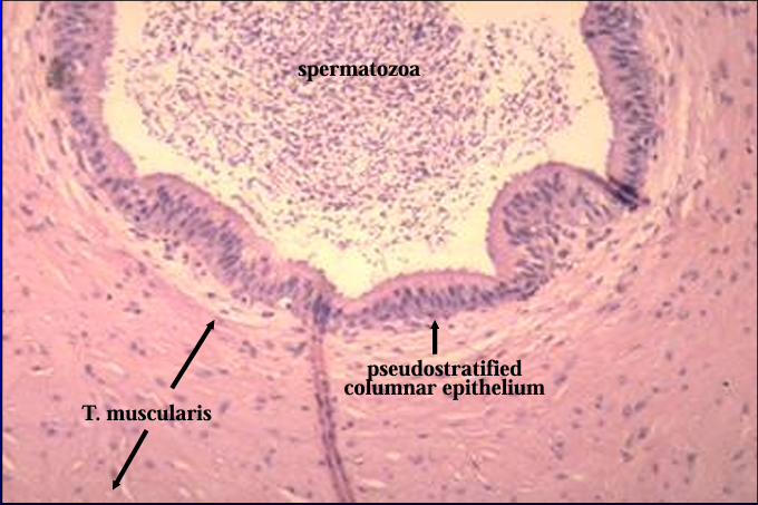 <p>Canine ductus deferens. </p><p>Spermatozoa are present in the lumen. </p><p>The mucosa is <strong>lined by a pseudostratified columnar epithelium. </strong></p><p>The tunica muscularis is a thick layer of smooth muscle.</p>