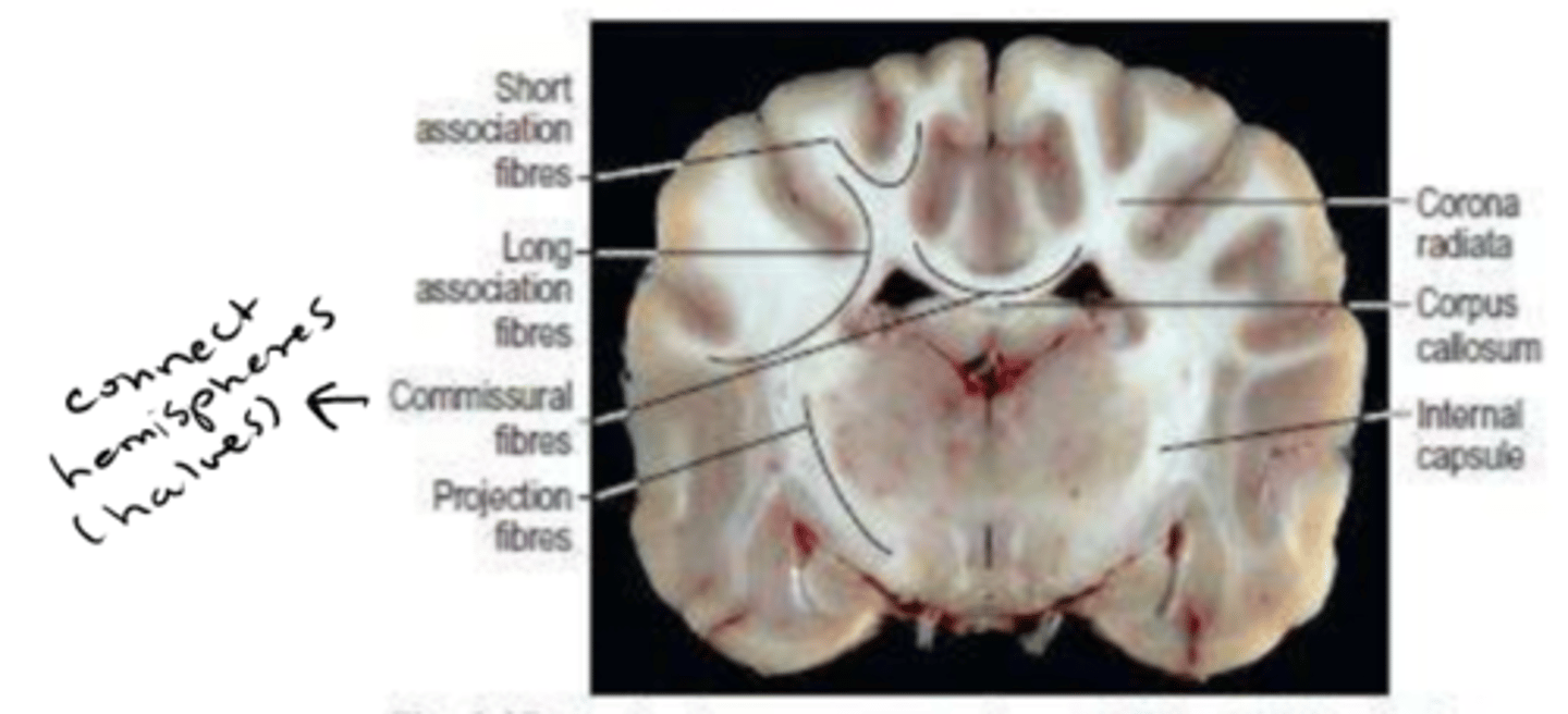 <p>commissure</p>