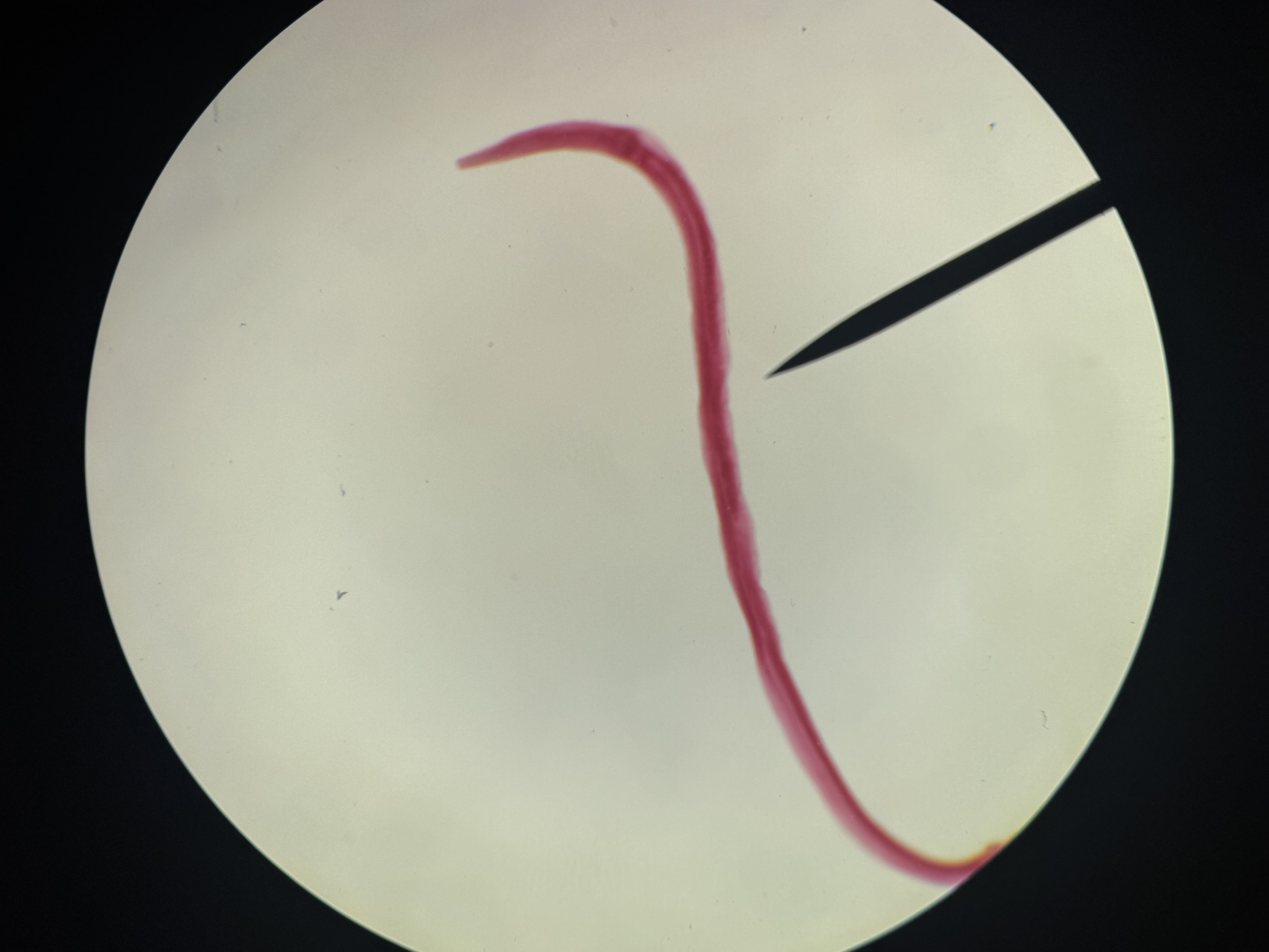 <p>Enterobius vermicularis</p>