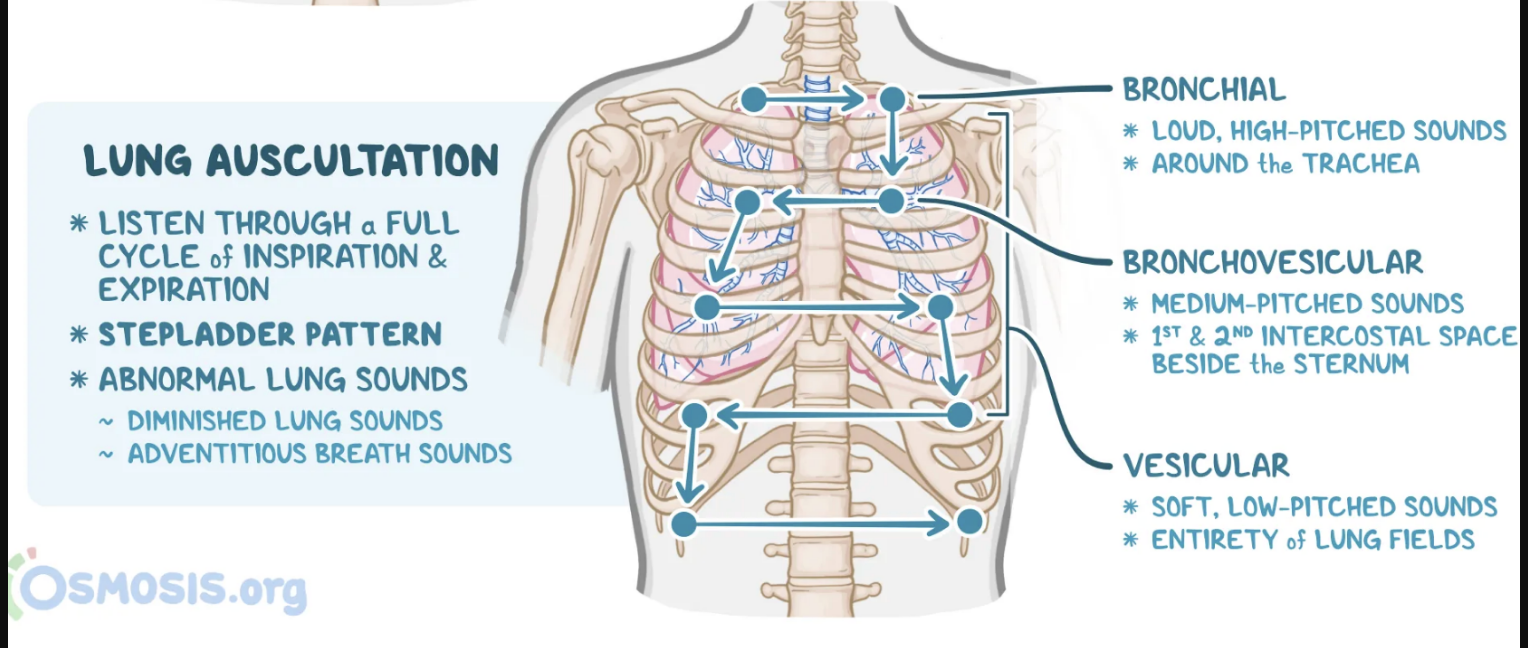 <p>Listen through entire breath-cycle <br>Use ladder pattern (moving from one side to the other and comparing symmetric areas of the lungs)<br><strong>NEVER</strong> listen through clothing<br>Put arms overhead for axillary areas</p>