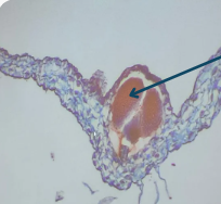 <p>What is the arrow pointing to on the Anthoceros Thallus?</p>