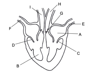 <p>Identify the structures of the heart labelled in the diagram below.</p>