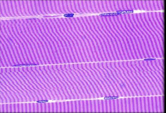 <p>Label the skeletal muscle </p>