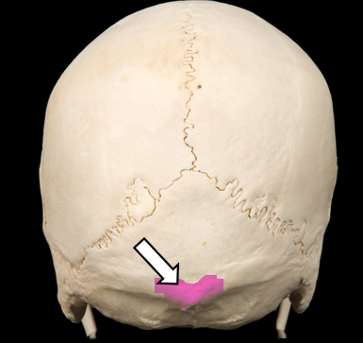 <p>name the part</p>