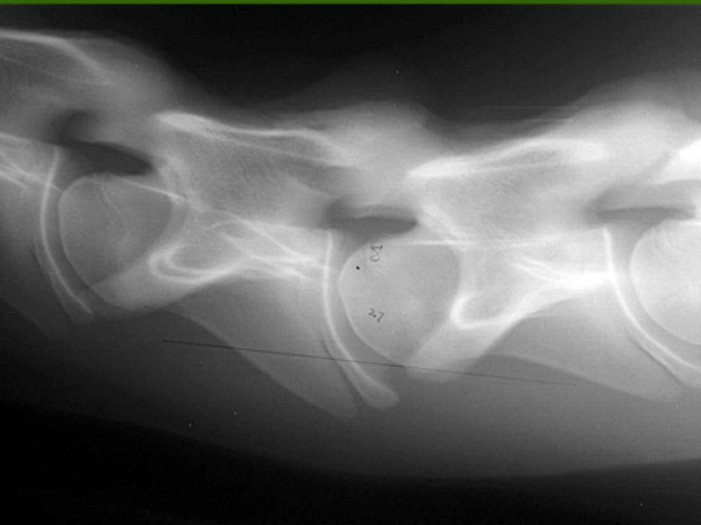 <p>What kind of fracture is this?</p>