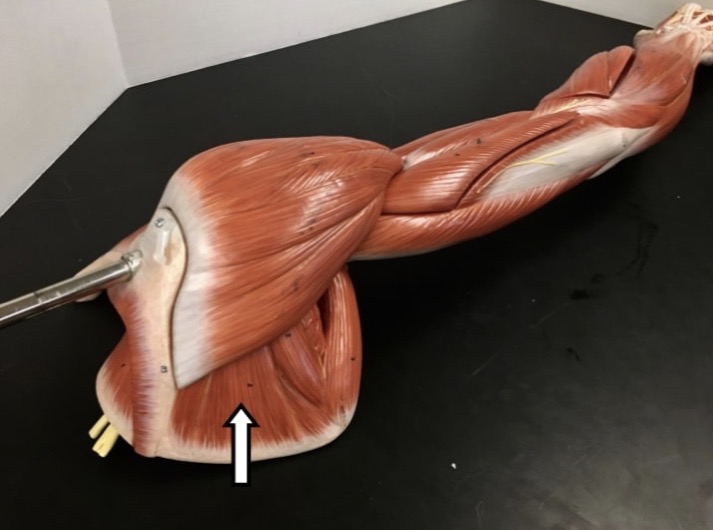<p><span>Name the muscle labeled with the white arrow below AND name the insertion</span></p>