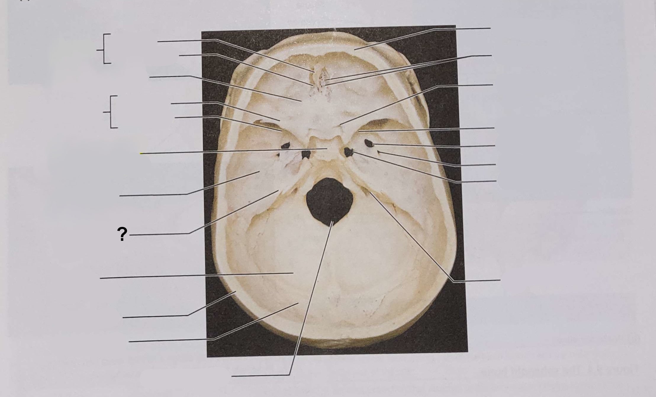 <p>Name the indicated structure</p>