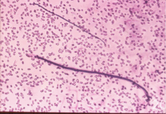 <p>What does this image show?</p>