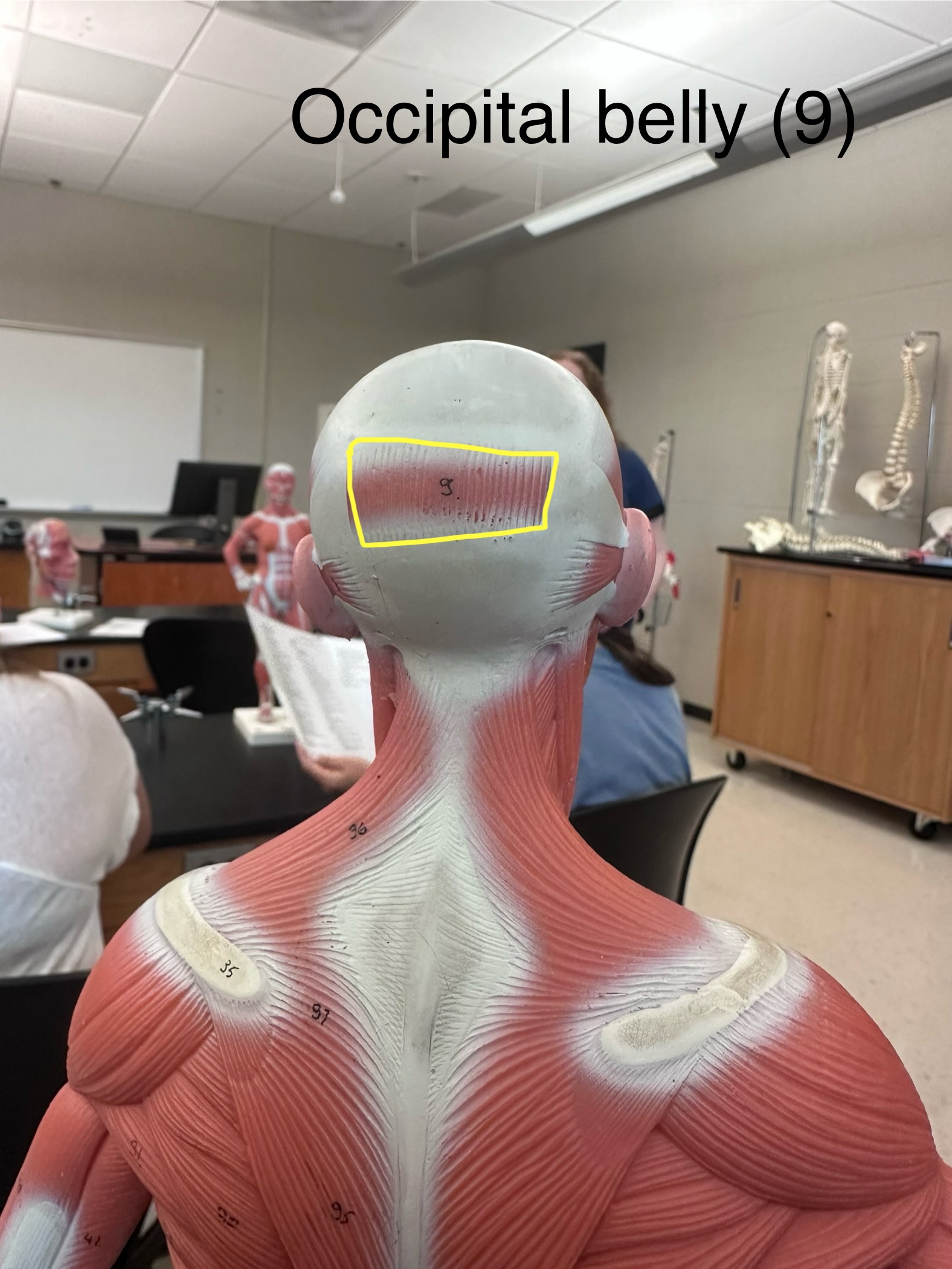 <p>Occipital belly muscle</p>