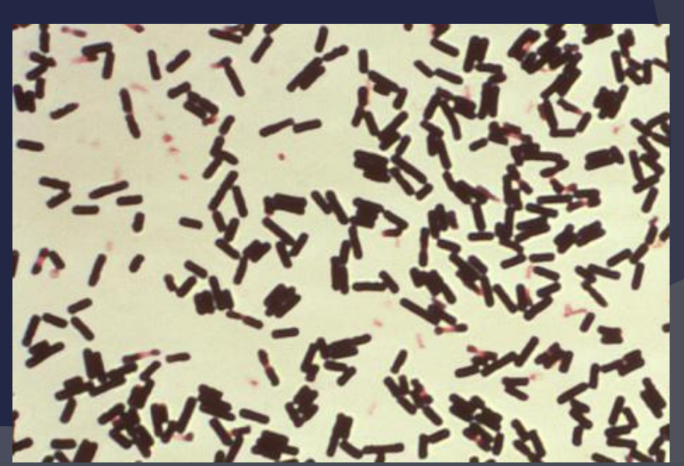 <p><span style="font-family: Arial, sans-serif">Clostridium perfringens</span></p>