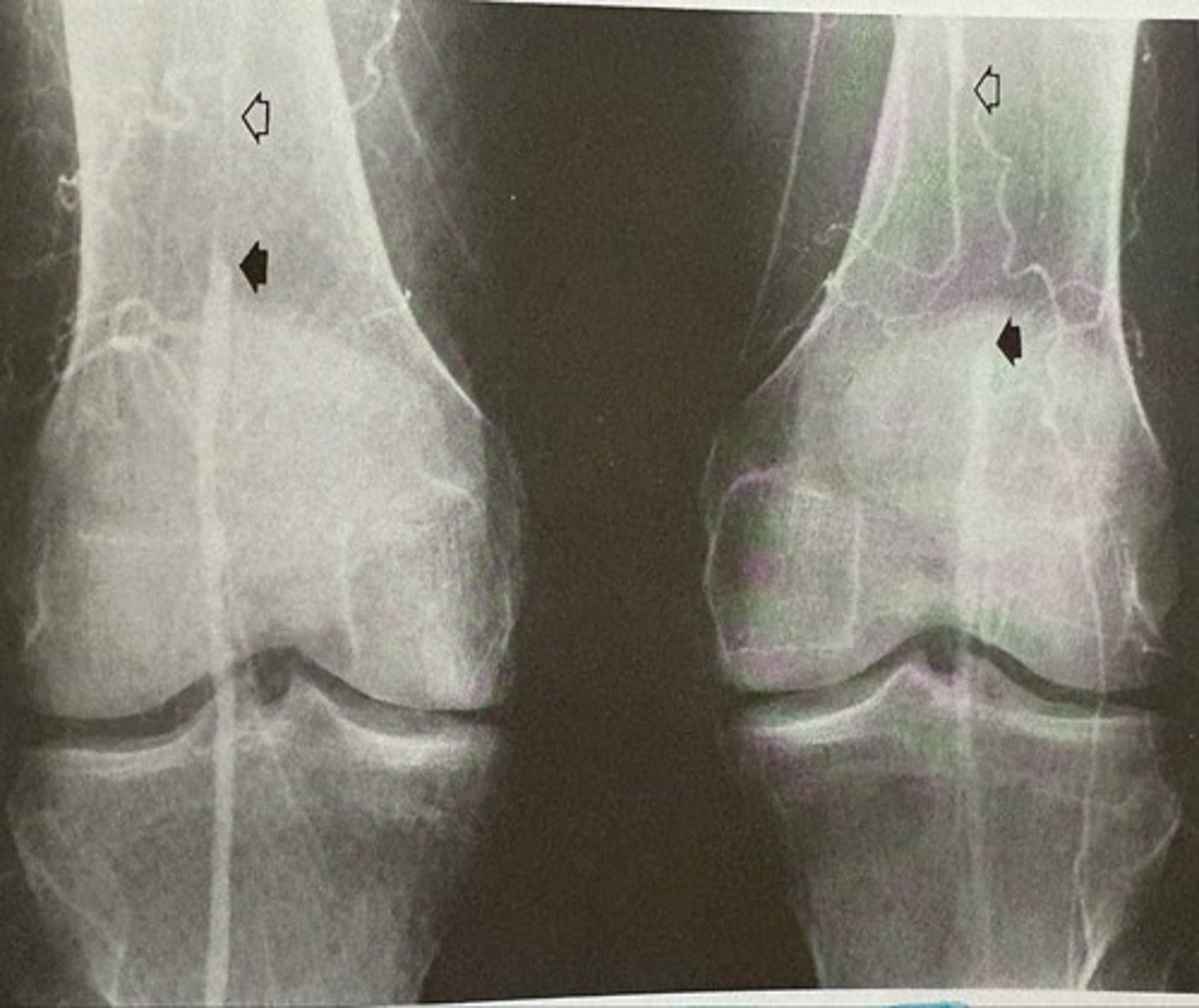 <p>what pathology is present?</p>