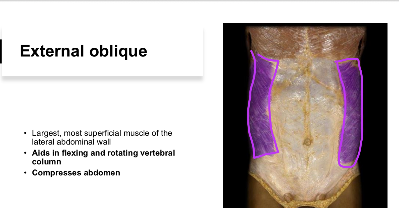 <p>Superficial muscles that compress the abdomen and flex the vertebral body.</p>