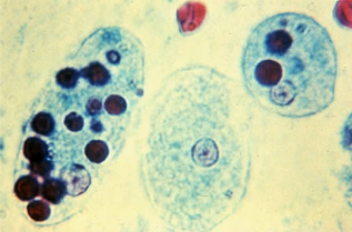 <p>Professor: Dr. Glena Fe A. Yapchulay-Alcabasa</p>