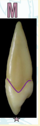 <p><mark data-color="green" style="background-color: green; color: inherit">maxillary canines #6 and #11; cusp tips proximal view</mark></p>