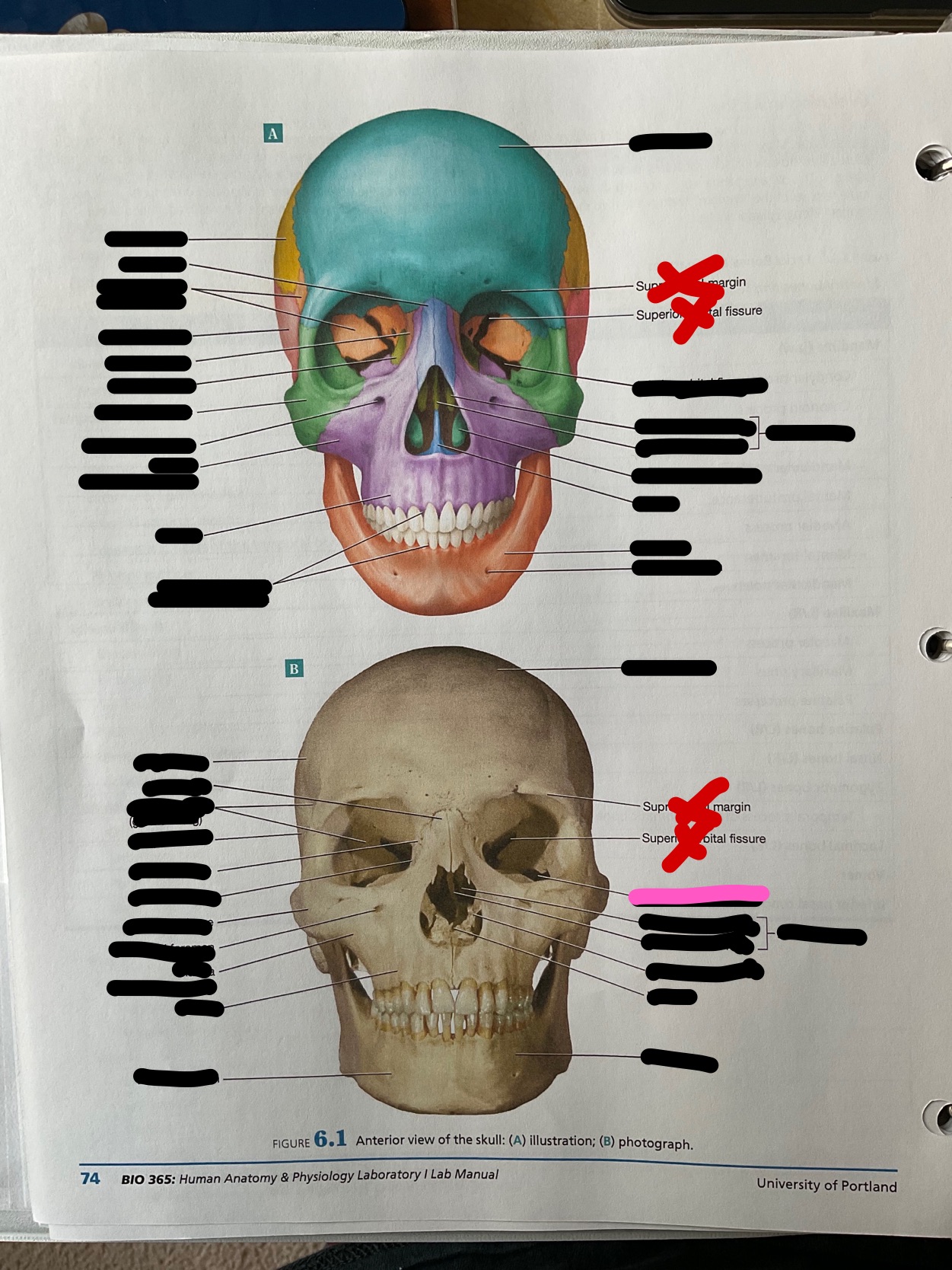 What bone feature is this?
