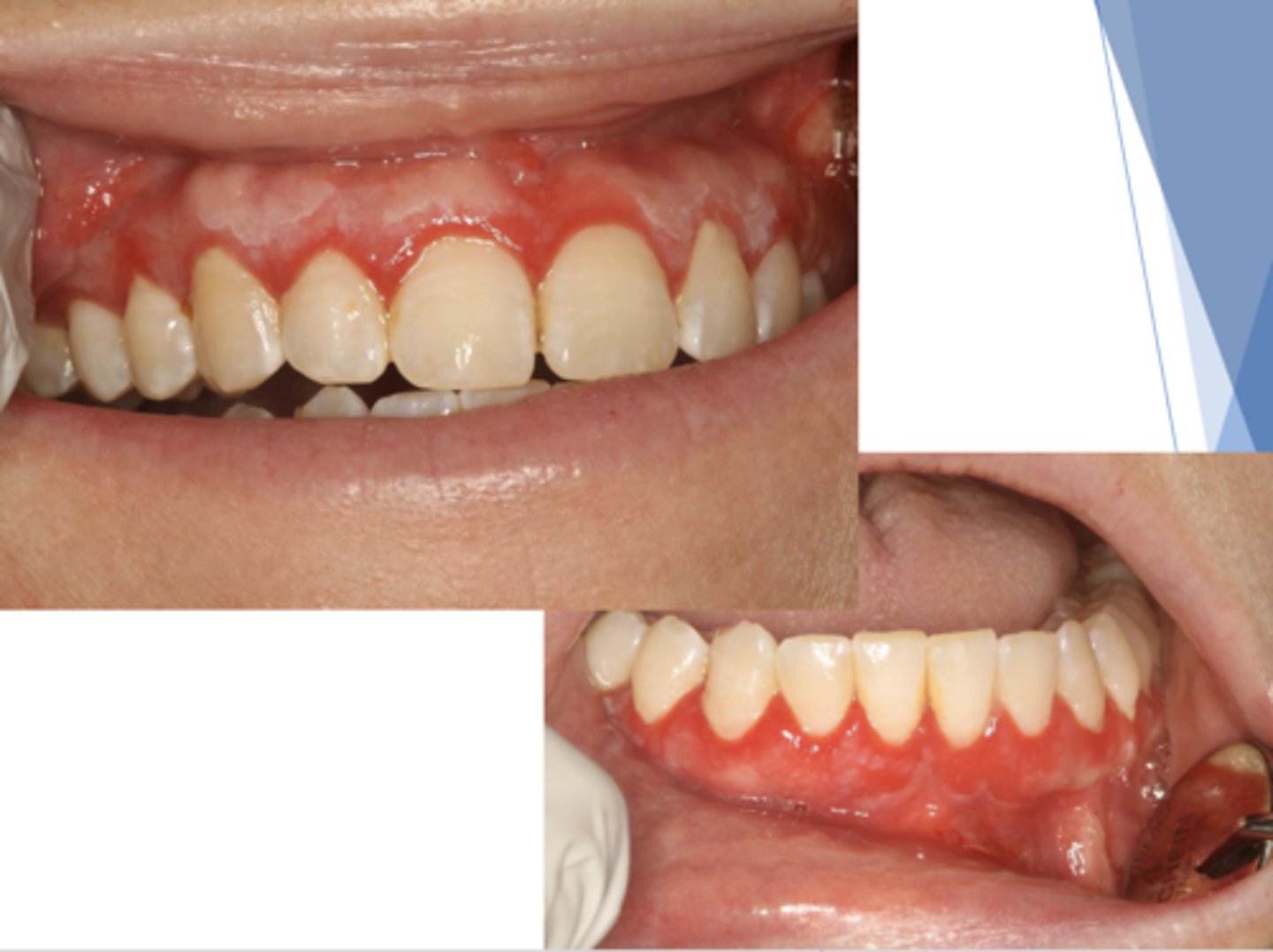 <p>What condition?</p>