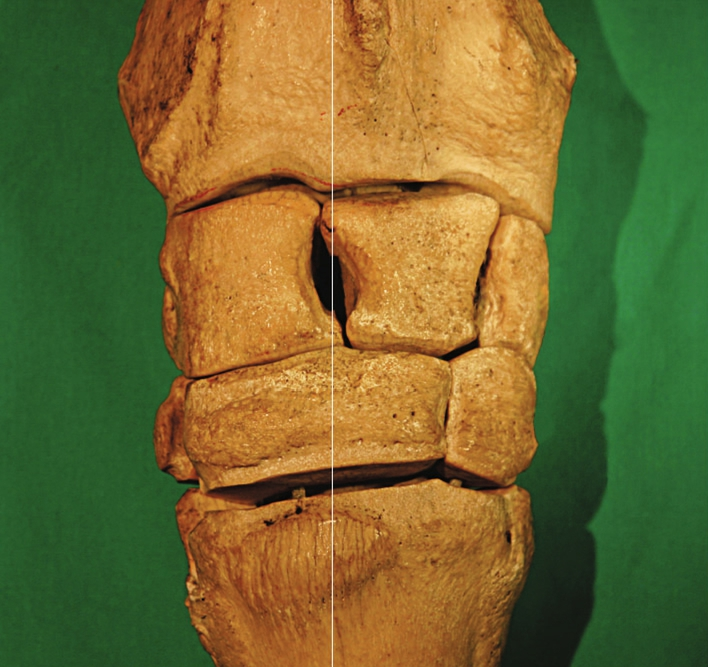 <p>Shape?</p>