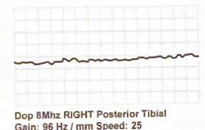 <p>Describe this pedal waveform:</p>