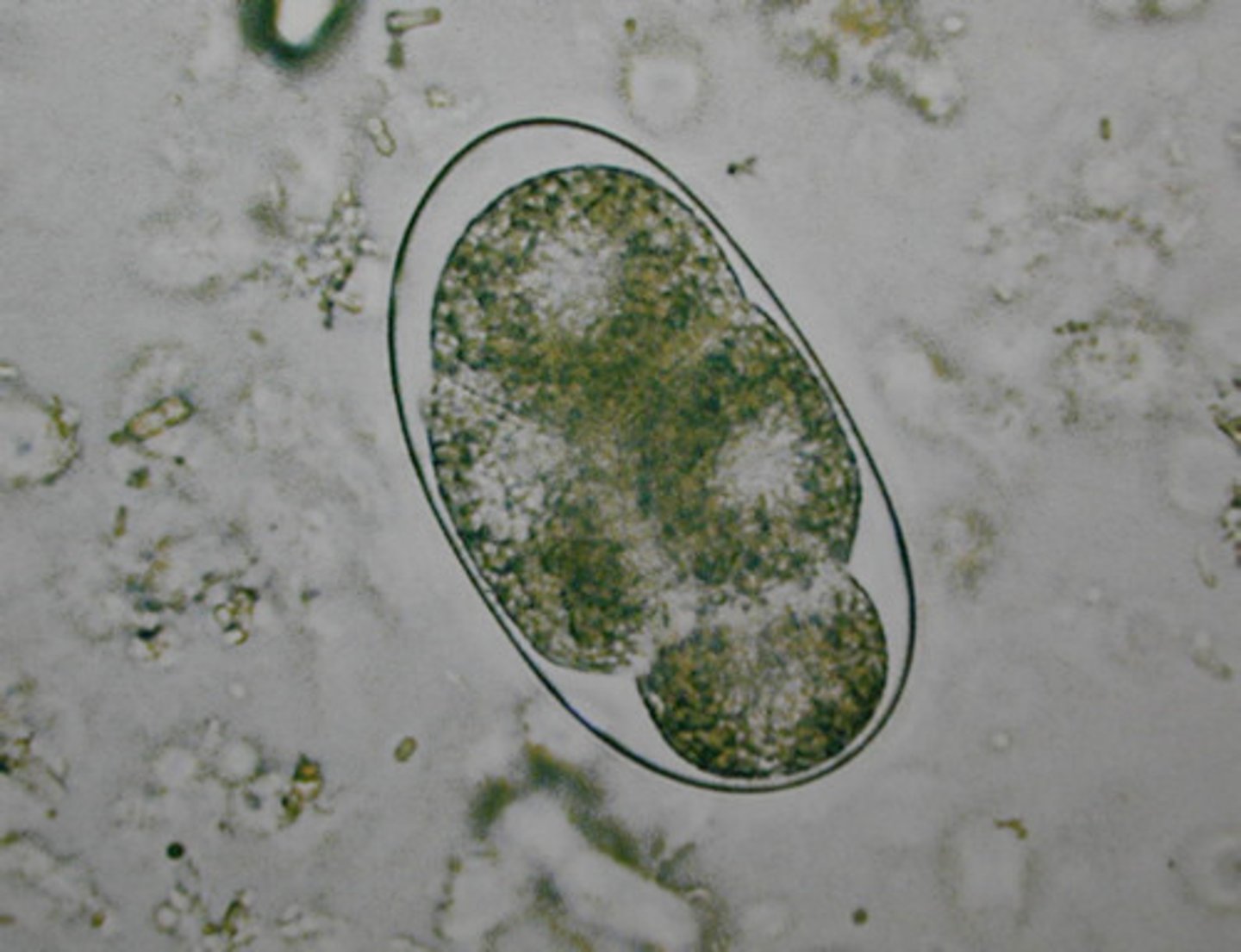 <p><strong><em>Hookworm</em></strong></p><p>Helminth (nematoda, roundworms)</p><p>fecal-oral route</p><p>fecal smear</p>