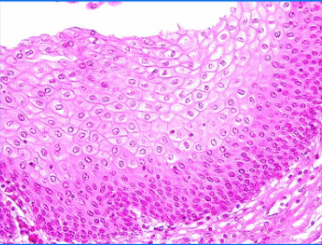 <ul><li><p><span style="background-color: transparent; font-family: "Book Antiqua", serif;"><span>Flat and irregular on free surface</span></span></p></li><li><p><span style="background-color: transparent; font-family: "Book Antiqua", serif;"><span>Protect against abrasion</span></span></p></li></ul><p></p>