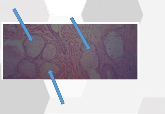 <p>What is this gland</p>