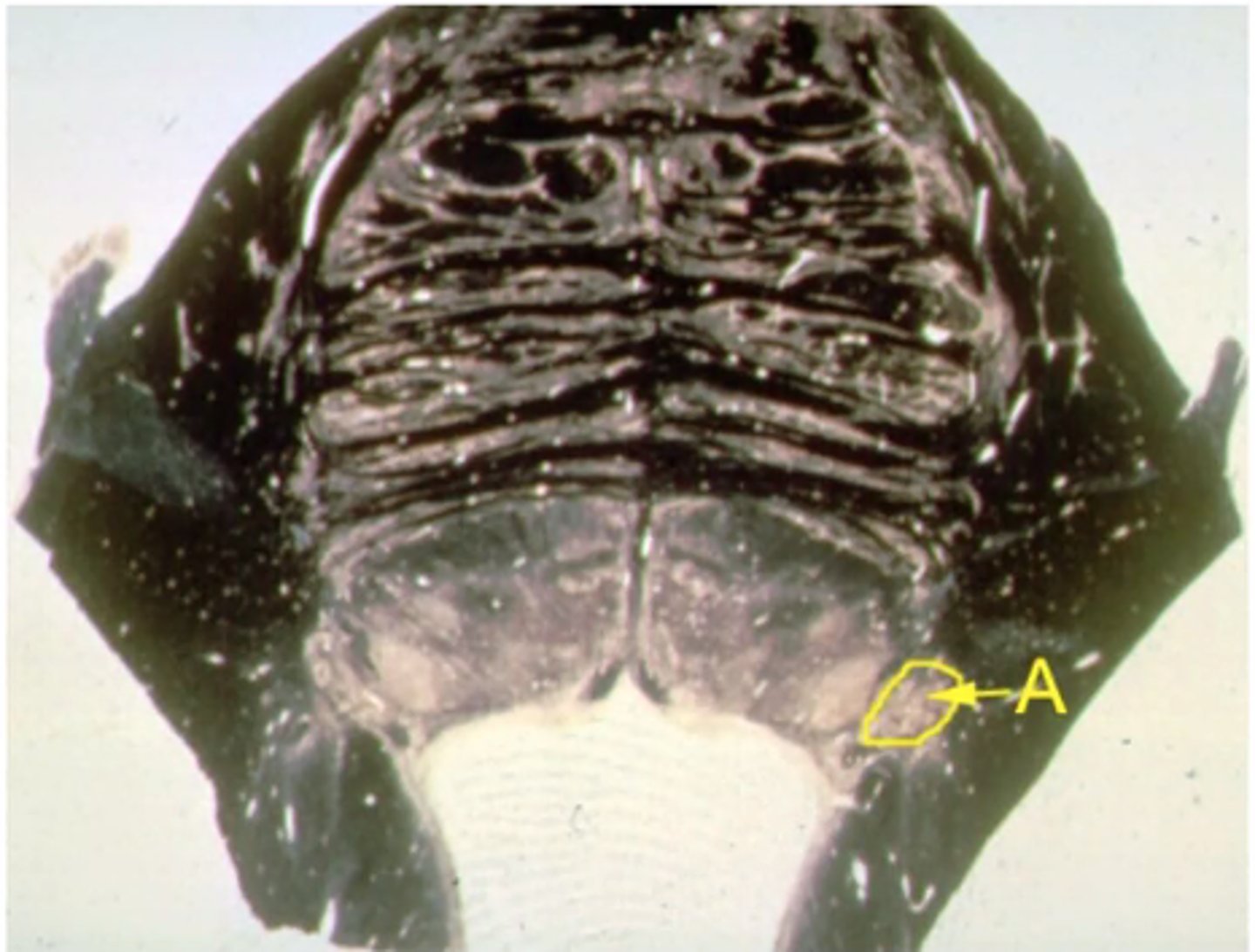 <p>What is the function of structure "A"?<br><br>A. Receives fine touch sensation from the ipsilateral face <br><br>B. Receives pain & temperature sensation from the ipsilateral face <br><br>C. Contains cell bodies whose axons innervates the ipsilateral muscle of mastications<br><br>D. Contains cell bodies whose axons innervates the ipsilateral muscles of facial expression <br><br>E. Receives pain & temp from contralateral face</p>