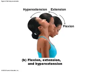 <p>Hyperextension</p>