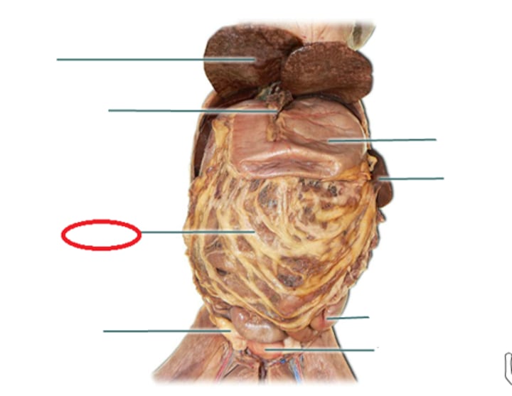 <p>Looks lacy and see through. Lines of fat and blood vessels.</p>