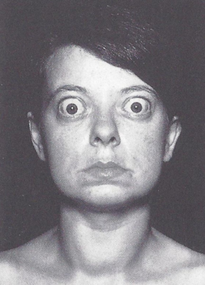 <p>Movement of eyeball</p>