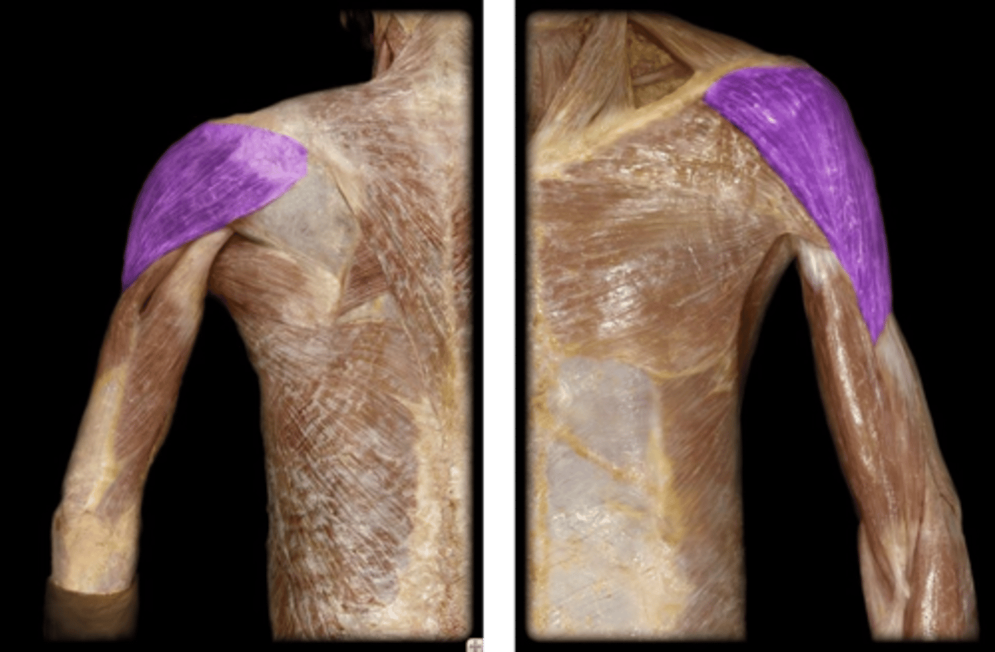 <p>What is the name of this muscle, highlighted in purple?</p>