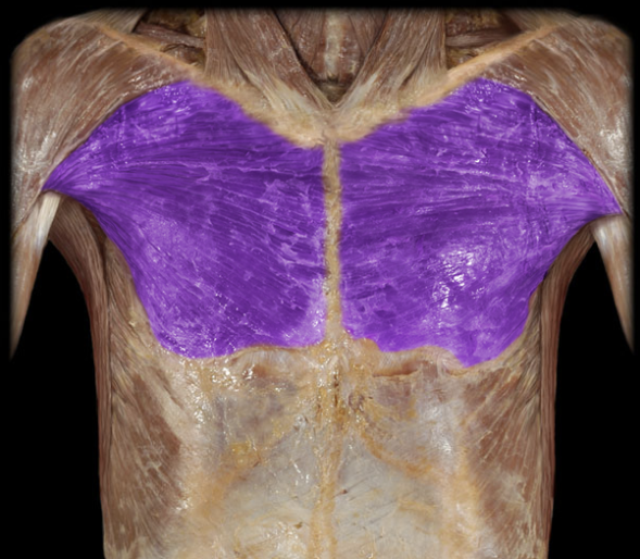 <p>anterior and superficial muscle of the chest, adducts &amp; flexes @ shoulder</p>