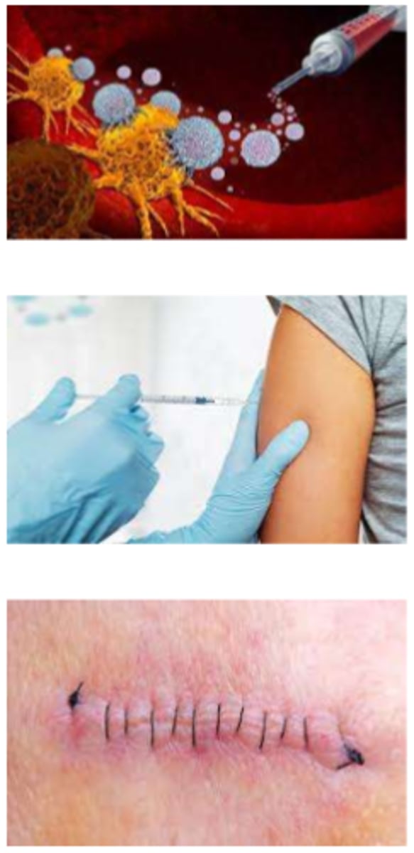 <p>- antiinfectives: eg. antibiotics (abx), antifungals (direct elimination of pathogen or its virulence)</p><p>- immunotherapy: eg. IVIG (supplementation with immune agents (eg. IgG))</p><p>- immunizations: stimulates antibody synthesis (eg. IgG) (preventative)</p><p>- surgery => removal of infected tissue or infectious agents (eg. excision, wound debridement, abscess drainage)</p>