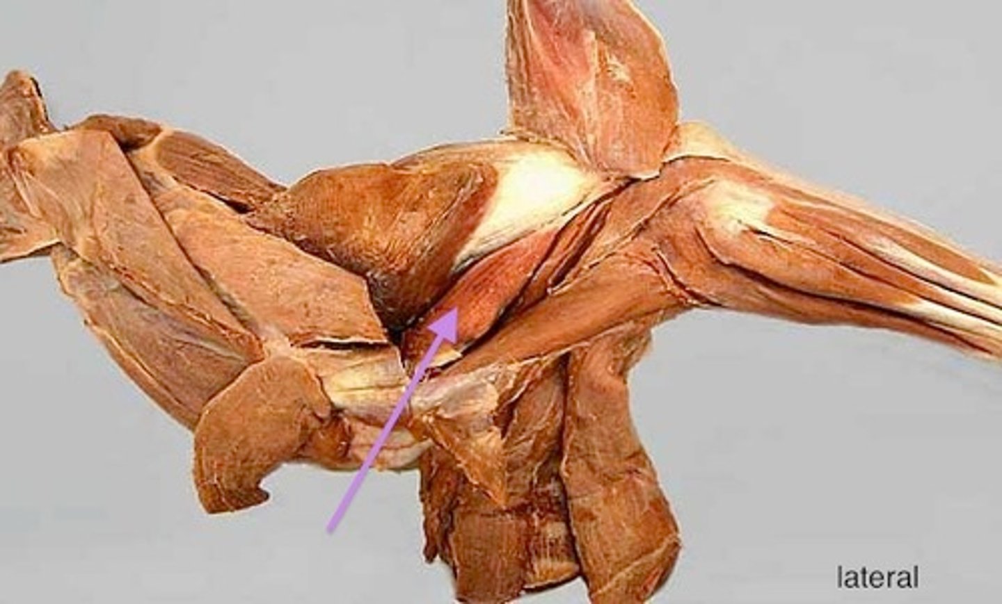 <p>What muscle is this?</p><p>Origin?</p><p>Insertion?</p><p>Action?</p><p>Nerve?</p>