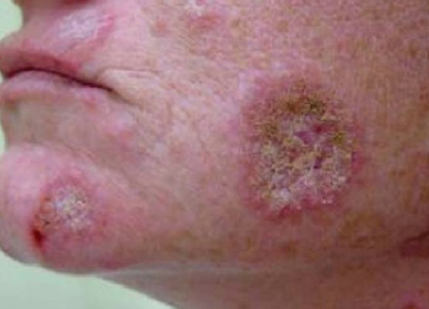 <p>What is the diagnosis?</p>