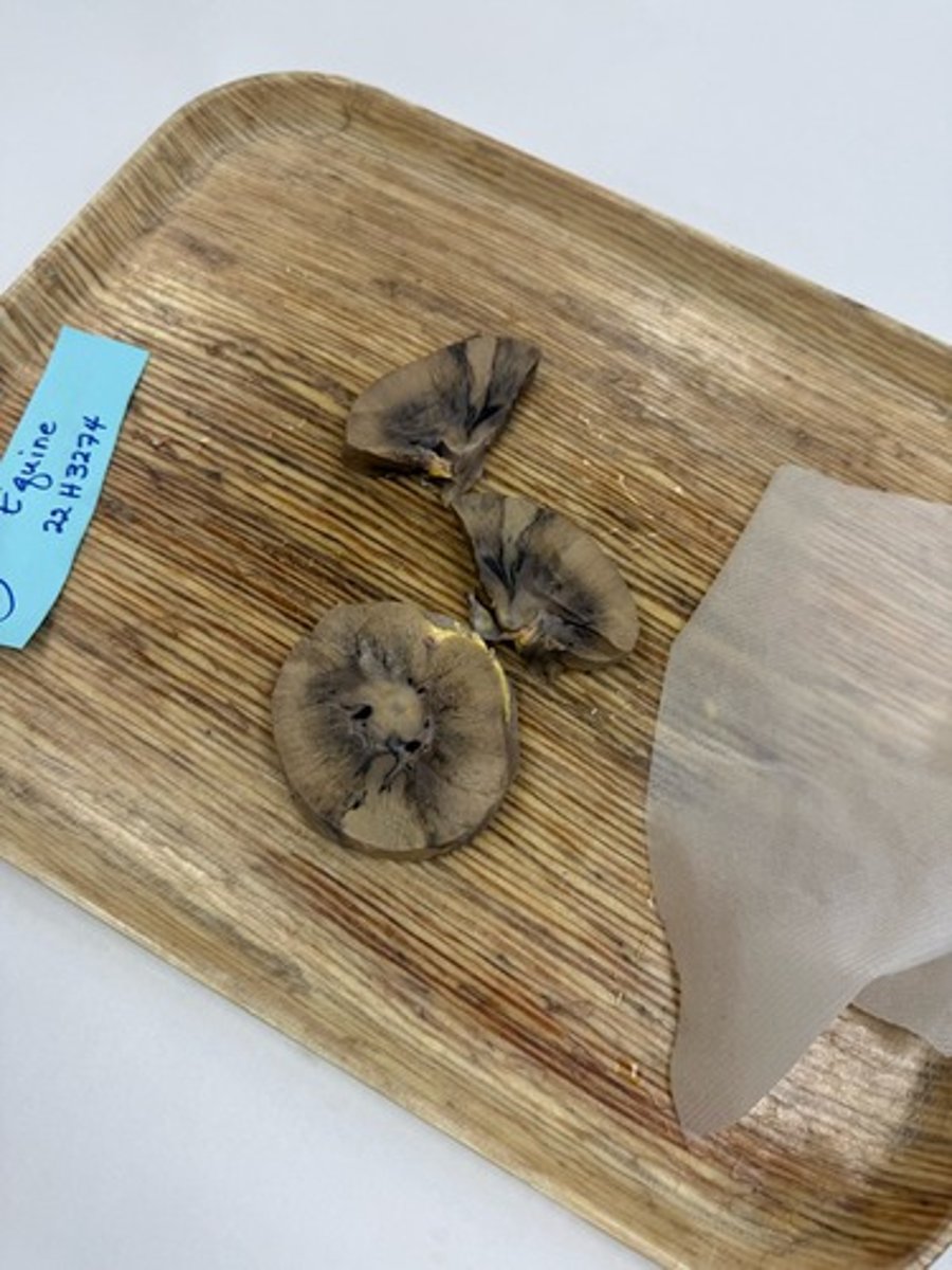 <p>What is lesion?</p>