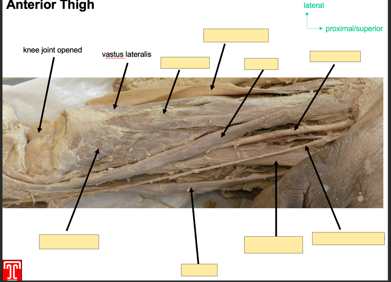 <p>Part of the quadriceps in the anteroior compartment of the thigh</p><p></p><p>Attachment: originates from greater trochanter </p><p>Inserts: base of patella via quadriceps tendon </p><p></p><p>Action: Extention of knee joint and stabalizes patella</p><p></p><p>Innervation: femoral Nerve </p><p>Artery: Femoral Artery </p><p></p>