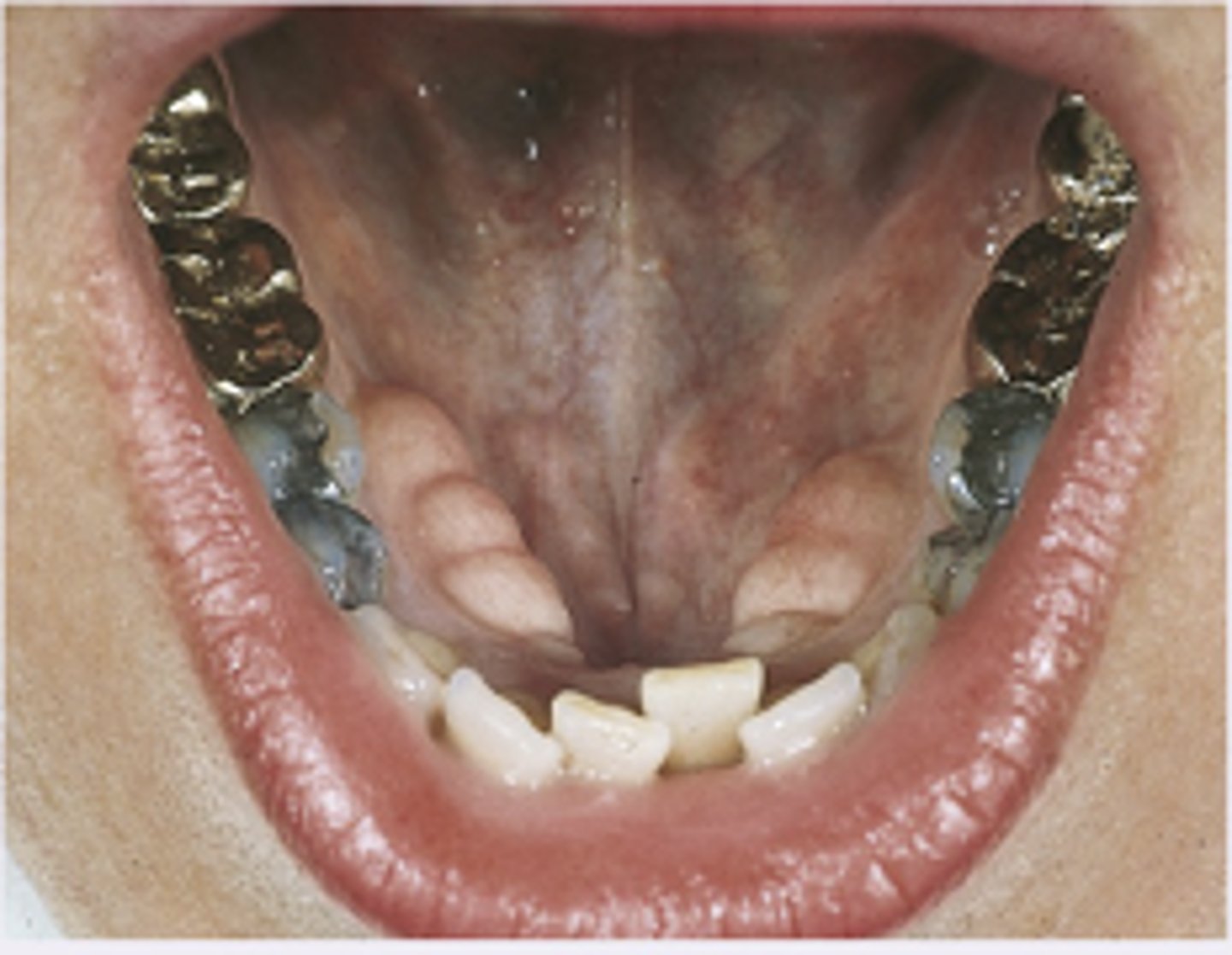 <p>Diagnosis?</p>
