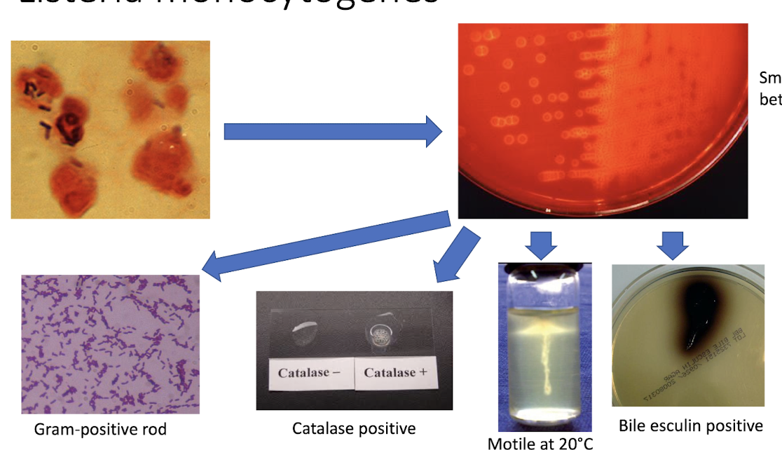 <ul><li><p>bacilli structure when stained</p></li><li><p>small zone of beta hemolysis on blood agar</p></li><li><p>gram + rod</p></li><li><p>catalase +</p></li><li><p>motile at 20C</p></li><li><p>bile esculin +</p></li></ul><p></p>