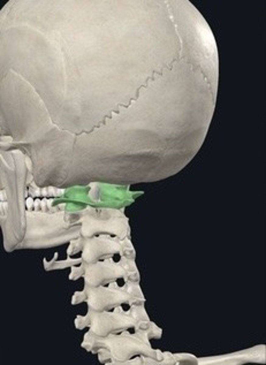 <p>First cervical vertebra supporting the skull.</p>