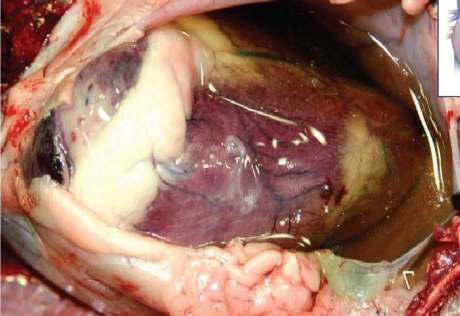 <p>What is this condition caused by?</p>