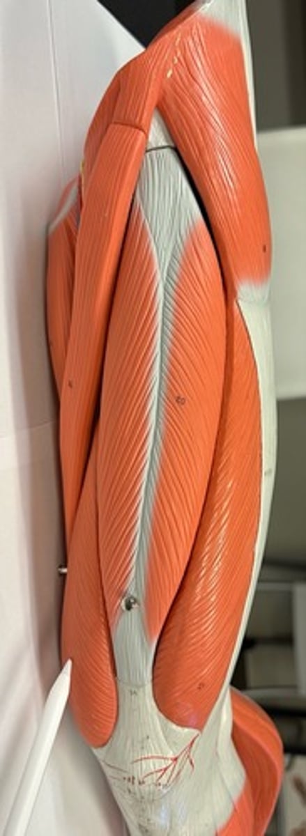 <p>What are the (5) attachments of the Vastus Medialis?</p>