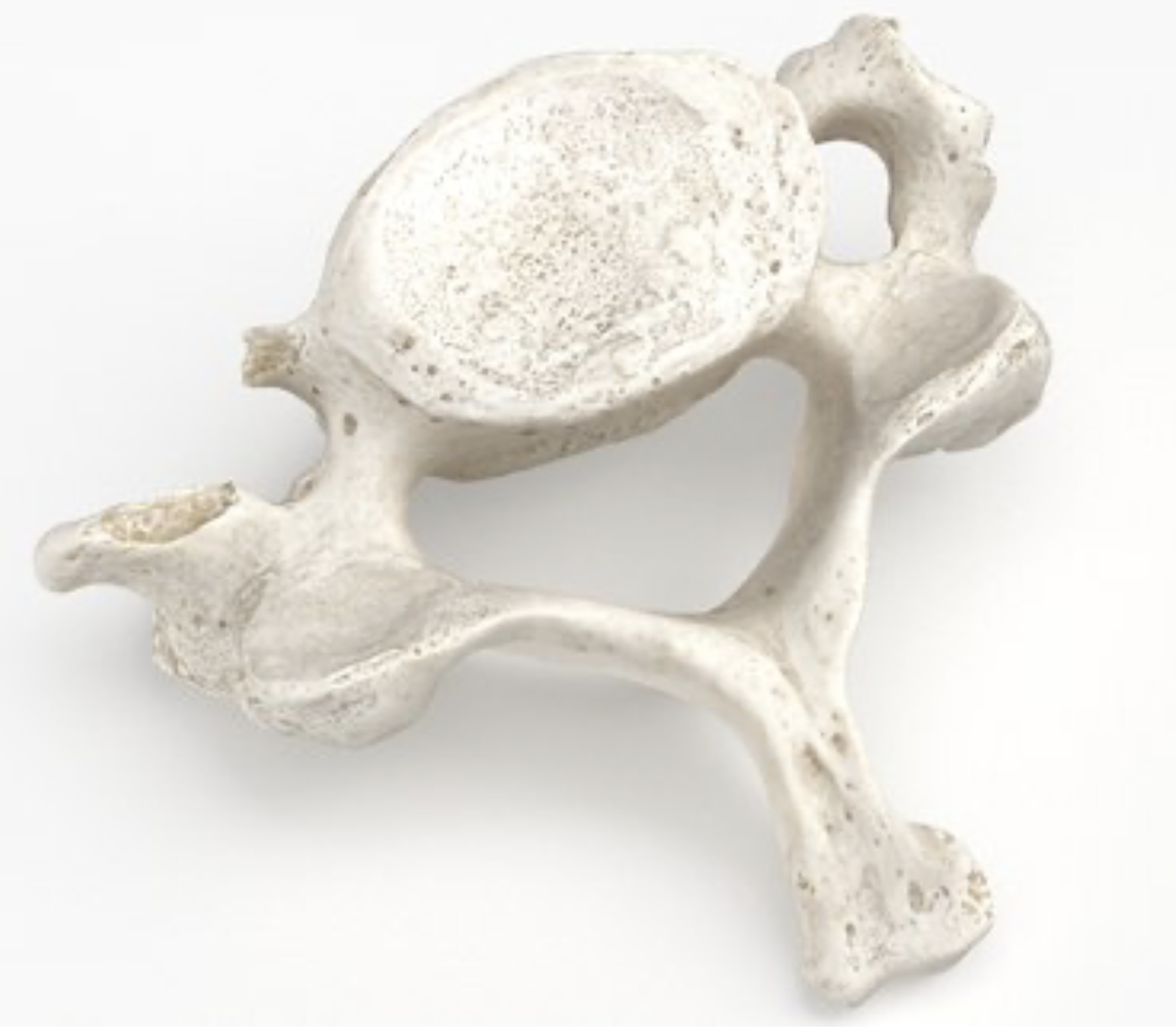 <p>What vertebra is this?</p>