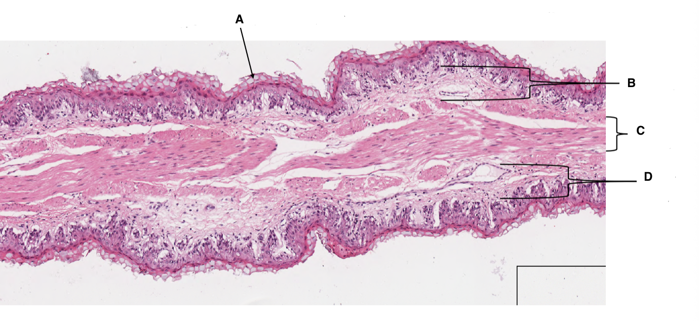 <p>what organ is this slide from?</p>