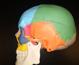 <p>What is this bone (lower orange region)?</p>
